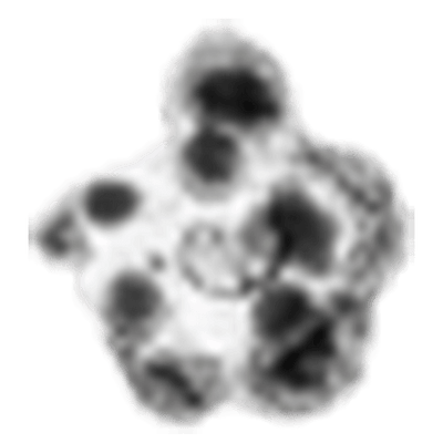 Schwermetalle